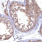 Immunohistochemical staining of human testis shows moderate membranous positivity in cells in seminiferous ducts.
