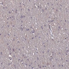 Immunohistochemical staining of human cerebral cortex shows no positivity in neurons as expected.