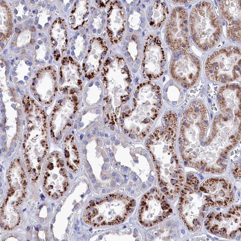 Anti-NUDT7 Antibody