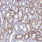 Anti-NUDT7 Antibody