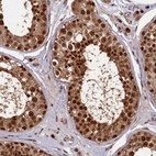 Immunohistochemical staining of human testis shows strong nuclear positivity in cells in seminiferous ducts.
