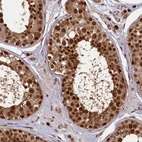 Immunohistochemical staining of human testis shows strong nuclear positivity in cells in seminiferous ducts.