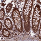 Immunohistochemical staining of human colon shows strong nuclear positivity in glandular cells.