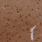 Immunohistochemical staining of human cerebral cortex shows strong nuclear positivity in neurons.