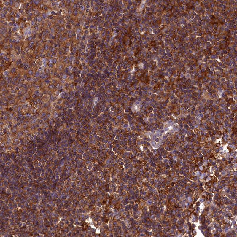 Anti-MYO9B Antibody