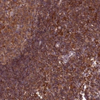 Anti-MYO9B Antibody