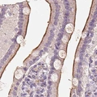 Immunohistochemical staining of human duodenum using Anti-TREH antibody HPA042045.