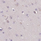 Immunohistochemical staining of human cerebral cortex using Anti-TREH antibody HPA042045.