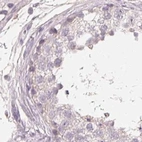 Immunohistochemical staining of human testis using Anti-TREH antibody HPA042045.