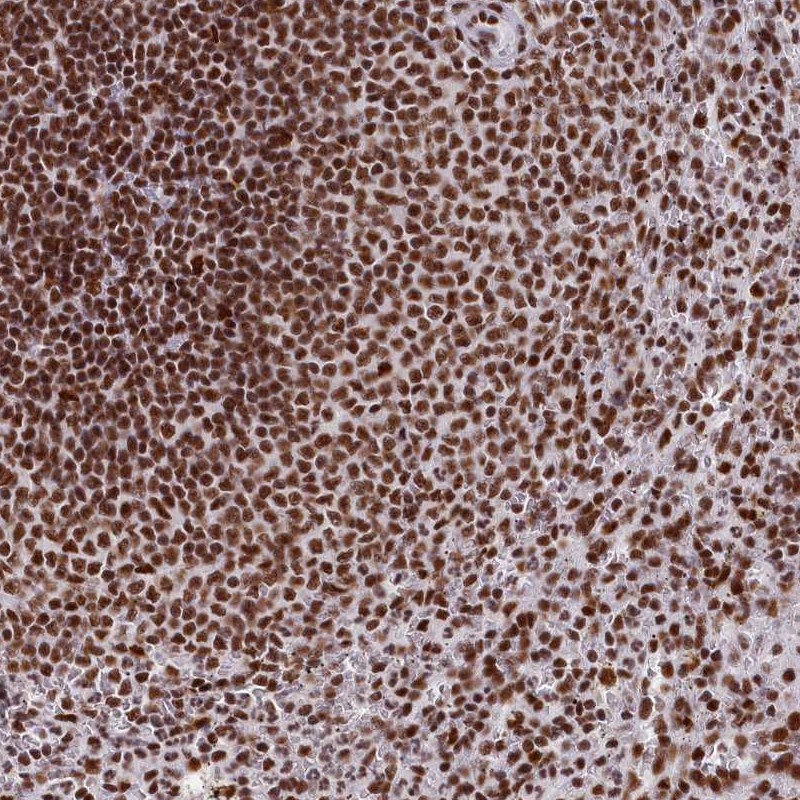 Anti-SNRNP70 Antibody