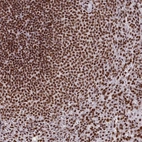 Anti-SNRNP70 Antibody