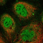 Immunofluorescent staining of human cell line A-431 shows localization to nucleoplasm, nuclear bodies, plasma membrane & cytosol.