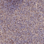 Anti-LENG8 Antibody