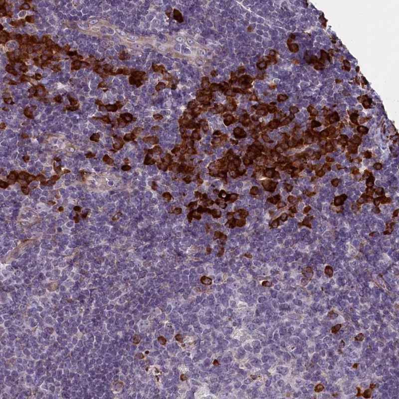 Anti-C16orf96 Antibody