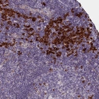Anti-C16orf96 Antibody