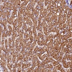 Anti-SIX5 Antibody