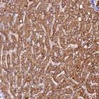 Anti-SIX5 Antibody