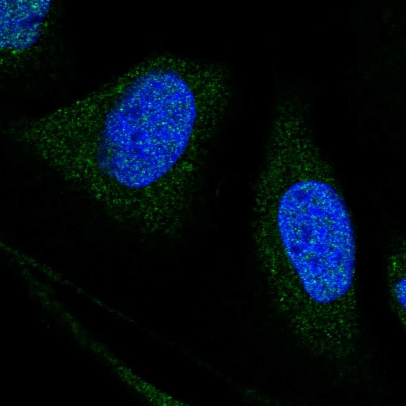 Anti-WDR7 Antibody