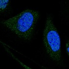 Anti-WDR7 Antibody