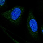 Anti-WDR7 Antibody