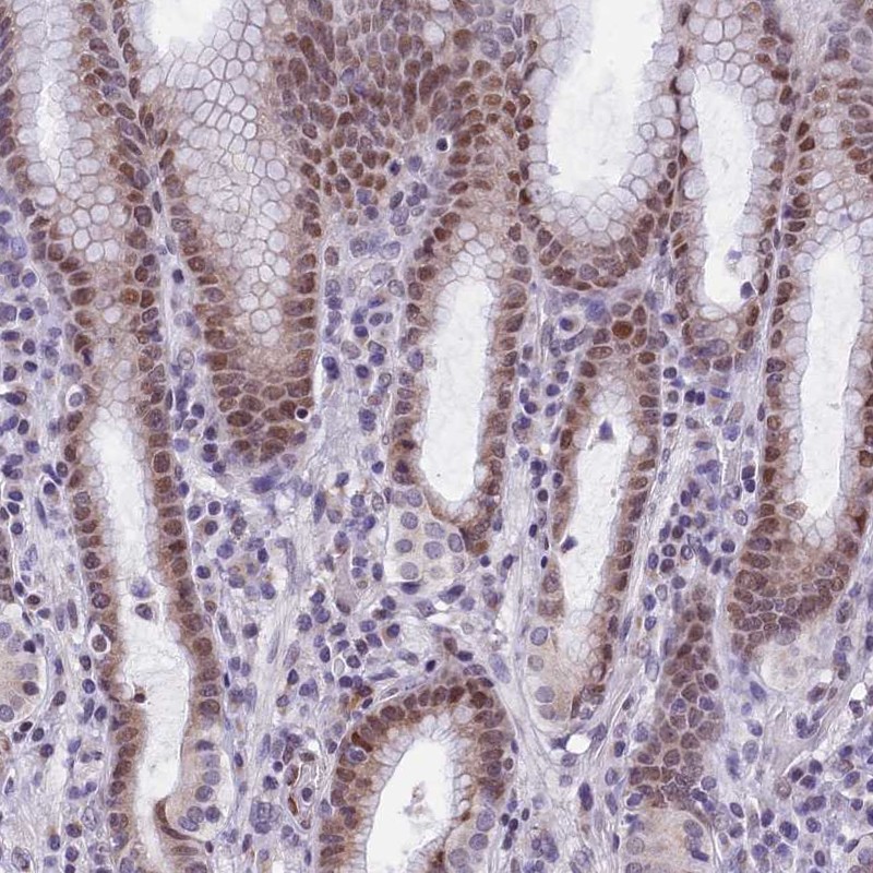 Anti-ZNF317 Antibody