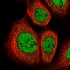 Immunofluorescent staining of human cell line A-431 shows localization to nucleoplasm.