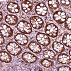 Anti-RPUSD2 Antibody