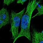 Immunofluorescent staining of human cell line U-251 MG shows localization to nucleoplasm & microtubules.
