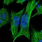 Immunofluorescent staining of human cell line U-251 MG shows localization to nucleoplasm & microtubules.