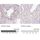 Anti-SYCE2 Antibody