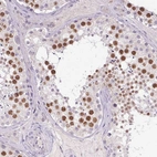 Immunohistochemical staining of human testis shows high expression.