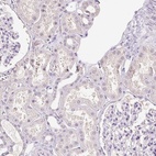 Anti-SYCE2 Antibody