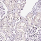 Immunohistochemical staining of human kidney shows low expression as expected.