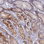 Anti-ZSWIM4 Antibody