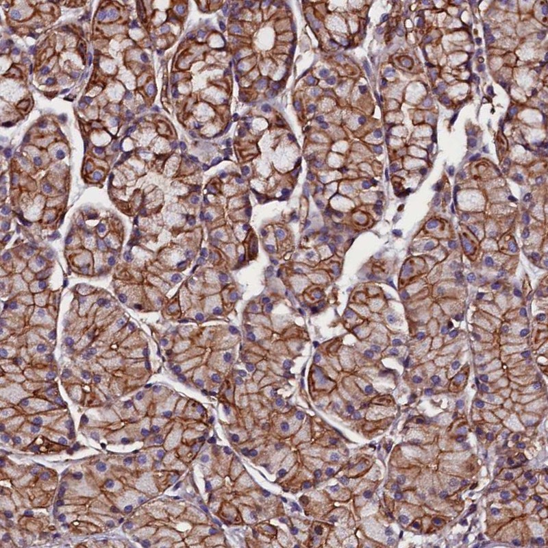 Anti-ZNF749 Antibody