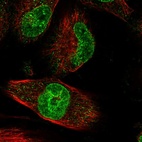 Immunofluorescent staining of human cell line U-251 MG shows localization to nucleoplasm & nuclear membrane.