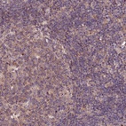 Anti-RINL Antibody