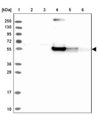 Lane 1: Marker [kDa] 250, 130, 95, 72, 55, 36, 28, 17, 10_br/_Lane 2: Human cell line RT-4_br/_Lane 3: Human cell line U-251MG sp_br/_Lane 4: Human plasma (IgG/HSA depleted)_br/_Lane 5: Human liver tissue_br/_Lane 6: Human tonsil tissue