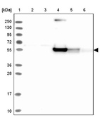 Anti-RINL Antibody