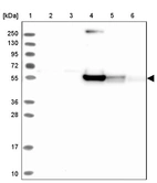 Lane 1: Marker [kDa] 250, 130, 95, 72, 55, 36, 28, 17, 10_br/_Lane 2: Human cell line RT-4_br/_Lane 3: Human cell line U-251MG sp_br/_Lane 4: Human plasma (IgG/HSA depleted)_br/_Lane 5: Human liver tissue_br/_Lane 6: Human tonsil tissue