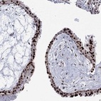 Anti-GSE1 Antibody