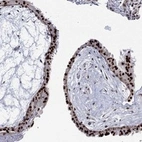 Anti-GSE1 Antibody