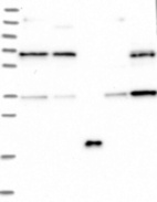 Lane 1: Marker [kDa] 250, 130, 95, 72, 55, 36, 28, 17, 10 | Lane 2: RT4 | Lane 3: U-251 MG | Lane 4: Human Plasma | Lane 5: Liver | Lane 6: Tonsil