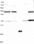 Lane 1: Marker [kDa] 250, 130, 95, 72, 55, 36, 28, 17, 10 | Lane 2: RT4 | Lane 3: U-251 MG | Lane 4: Human Plasma | Lane 5: Liver | Lane 6: Tonsil