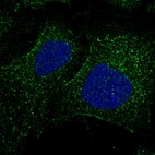 Immunofluorescent staining of human cell line U-2 OS shows localization to cytosol.