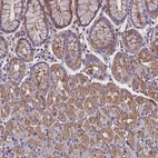 Anti-ZNF749 Antibody