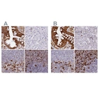Immunohistochemical staining of human colon, liver, lymph node and spleen using Anti-APOBR antibody HPA042093 (A) shows similar protein distribution across tissues to independent antibody HPA041667 (B).