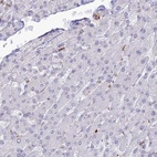 Immunohistochemical staining of human liver shows low expression as expected.