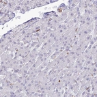 Immunohistochemical staining of human liver shows low expression as expected.