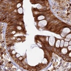Immunohistochemical staining of human colon using Anti-APOBR antibody HPA042093.